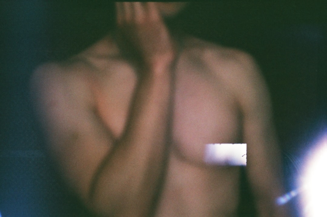 Photo dislocated shoulder