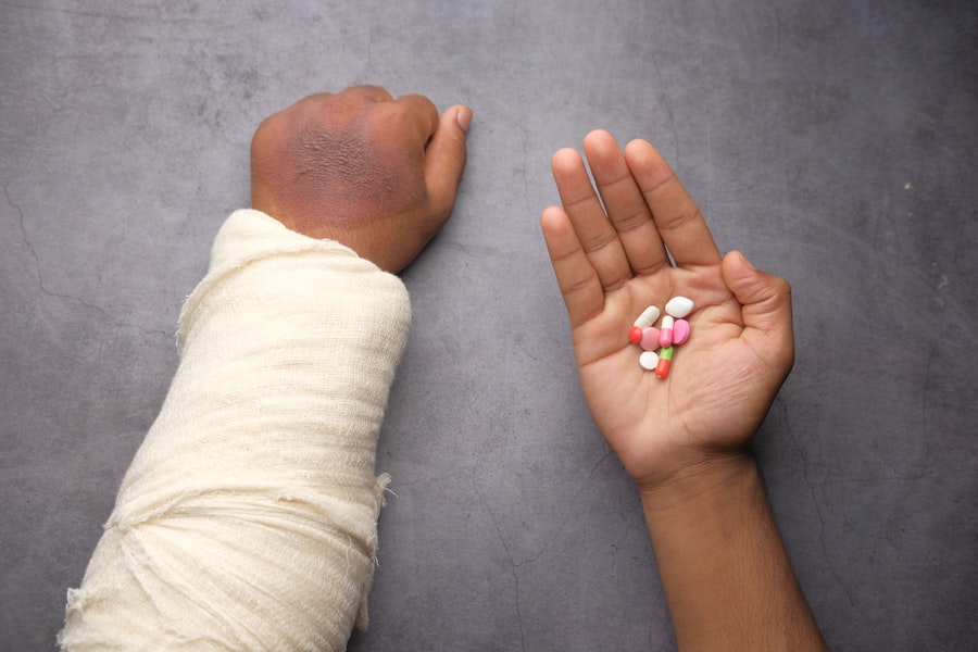 protect joints